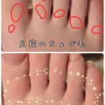 美容電気脱毛足の指