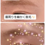 美容電気脱毛眉周り